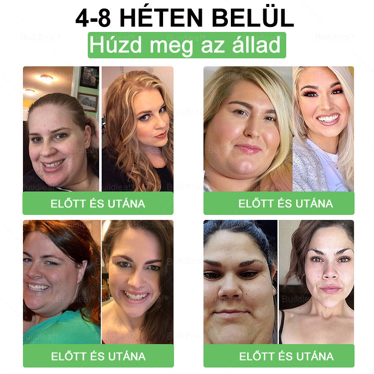 đ Klinikai kutatĂĄsokkal igazolt | A BuildLeafÂź Berberine GLP-1 Pro SĂșlycsökkentĆ SzĂĄjon ĂĄt szedhetĆ oldat segĂthet a makacs sĂșlytöbblet, anyagcsere- Ă©s energiaproblĂ©mĂĄk kezelĂ©sĂ©ben, tĂĄmogatva a jobb közĂ©rzetet Ă©s vitalitĂĄst