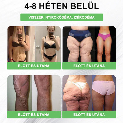 💚 Klinikai kutatásokkal igazolt | A BuildLeaf® Berberine GLP-1 Pro Súlycsökkentő Szájon át szedhető oldat segíthet a makacs súlytöbblet, anyagcsere- és energiaproblémák kezelésében, támogatva a jobb közérzetet és vitalitást